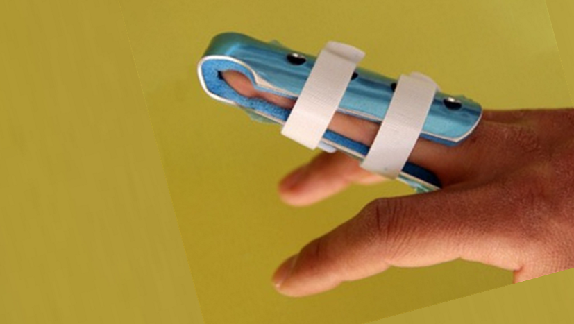 Falange sujeta con ferula de emergencia